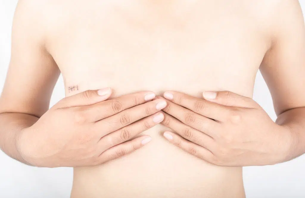 Gain Your Confidence Back with a Proper Fit: A Better Mastectomy