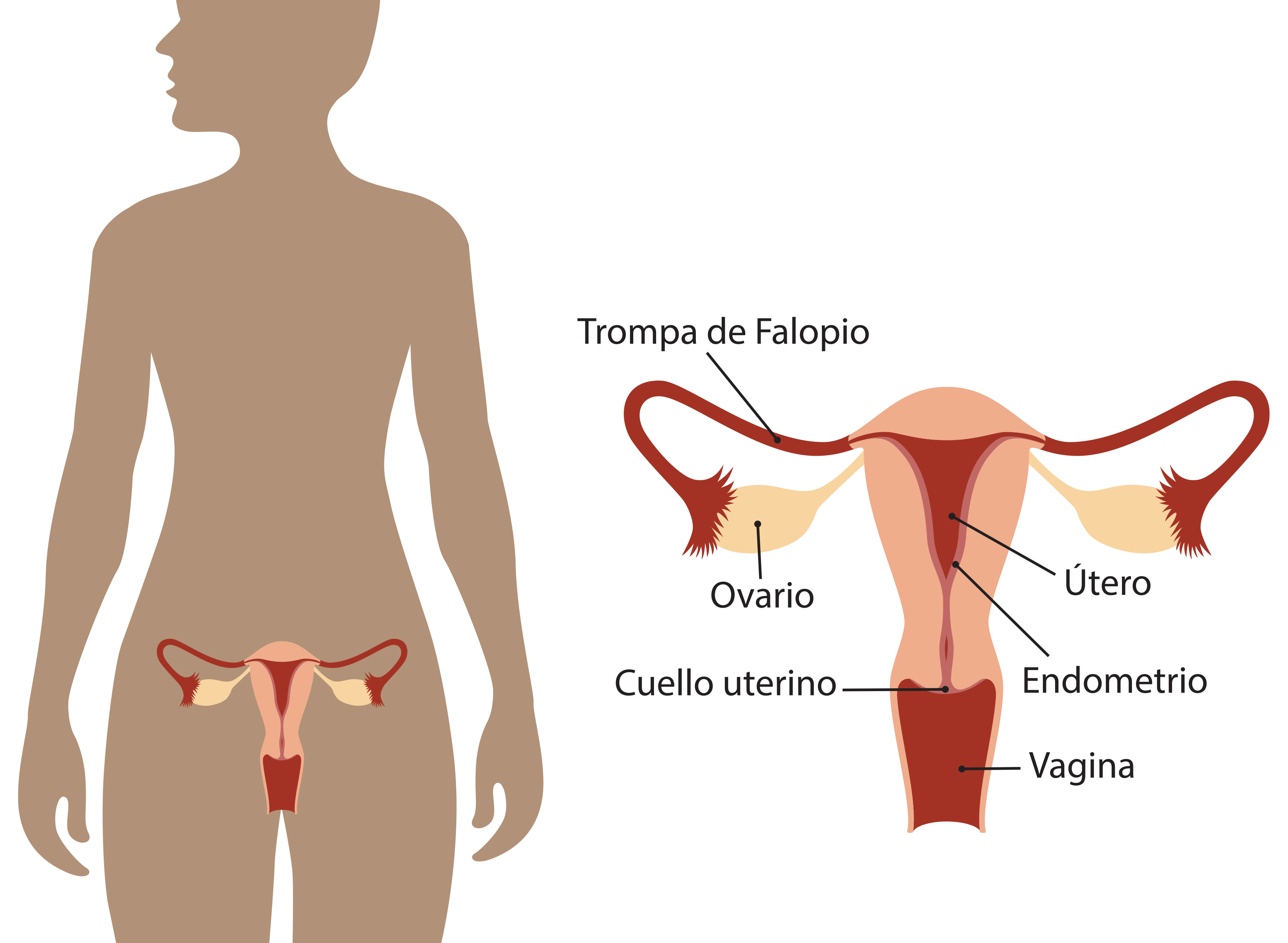 ooforectomia-extirpacion-ovario